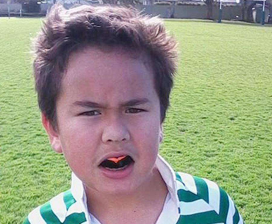 Rugby: Mouth guards compulsory