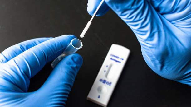 Tourism operators seek clarity on rapid antigen testing